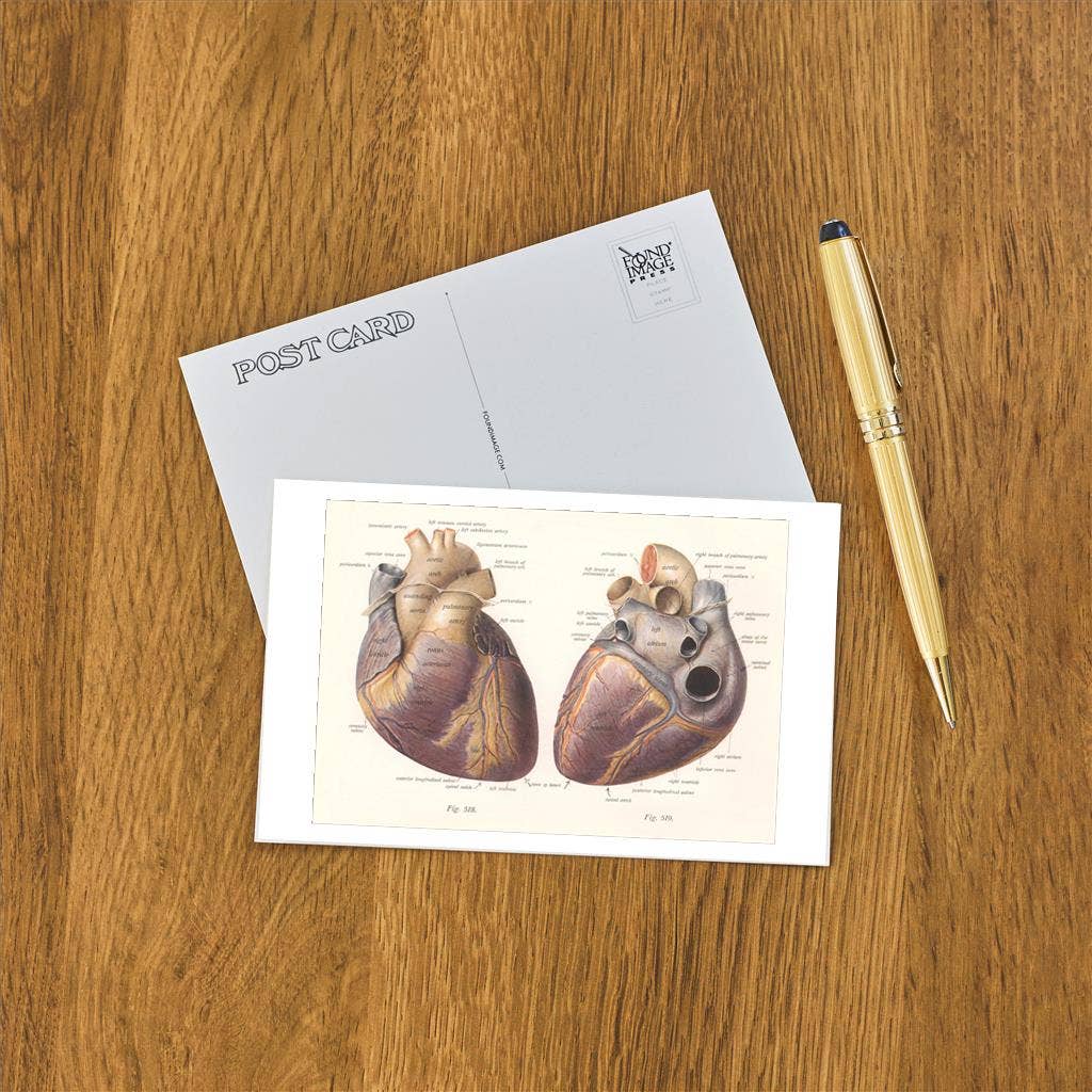 Postcard Diagrams of the Heart AY - 181 - Loved To Death