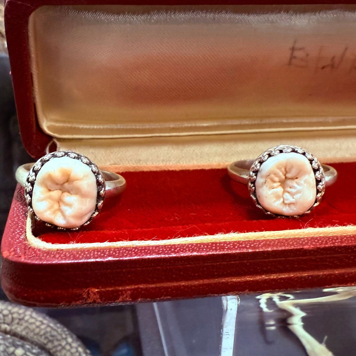 Human Teeth Rings Human Tooth Ring Sterling Crown Setting – Loved To Death